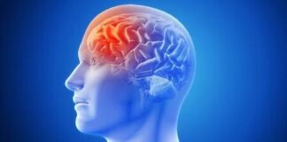 Calor pode aumentar risco de casos de AVC, alerta médico