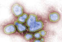 Sergipe está entre os estados com aumento na circulação da Influenza A, aponta Fiocruz