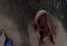 Família de jovem de Poço Verde denuncia negligência no Hospital São José após paciente ter parte da orelha arrancada durante agressão